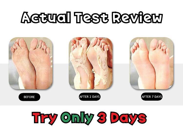 ALOE VERA KOREA Aloe Vera Foot Cream MIIN FOOT (Mi In Bal) (70g) - CoKoYam